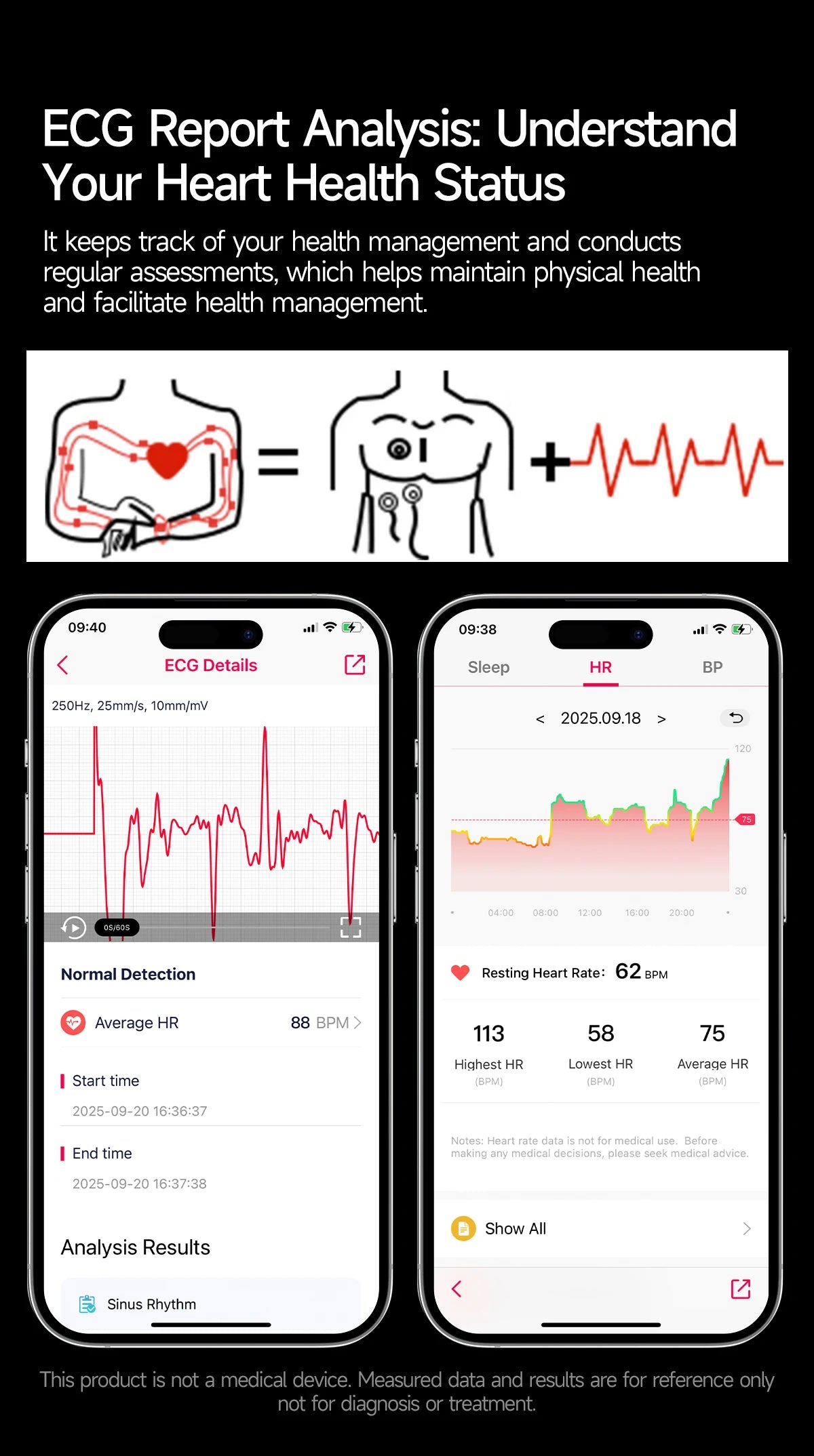 2026 AI Health Smartwatch ECG + PPG, Blood Pressure, Uric Acid & Body Fat Monitoring, AMOLED Display & Bluetooth Calling